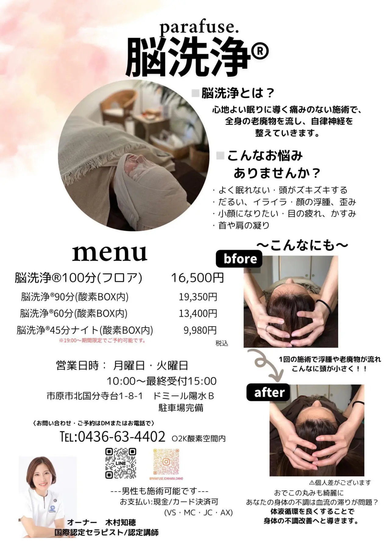 脳洗浄